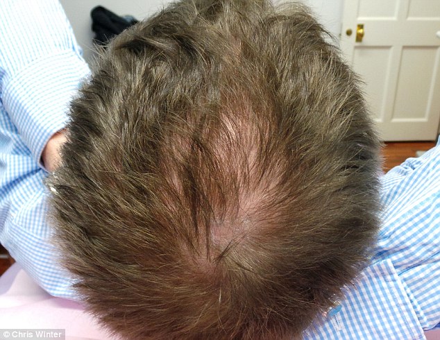 best way to regrow your hair naturally